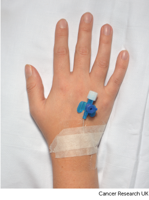 Photograph of a cannula 