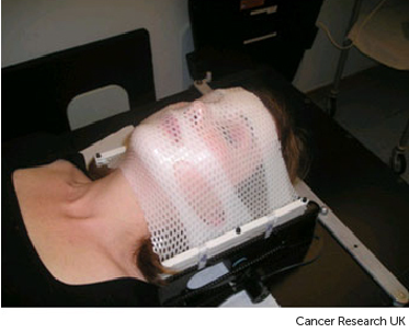 Photograph of a stereotactic radiotherapy mask for treating brain, head and neck cancers